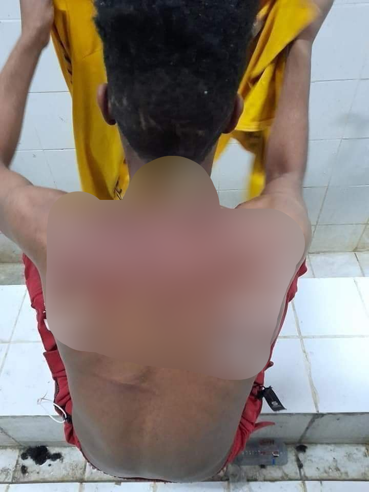 Von einem Häftling in Saudi-Arabien gesendetes Foto.  Auf seinem Rücken sind Spuren einer Peitsche zu sehen.  August 2021. © Frankreich 24