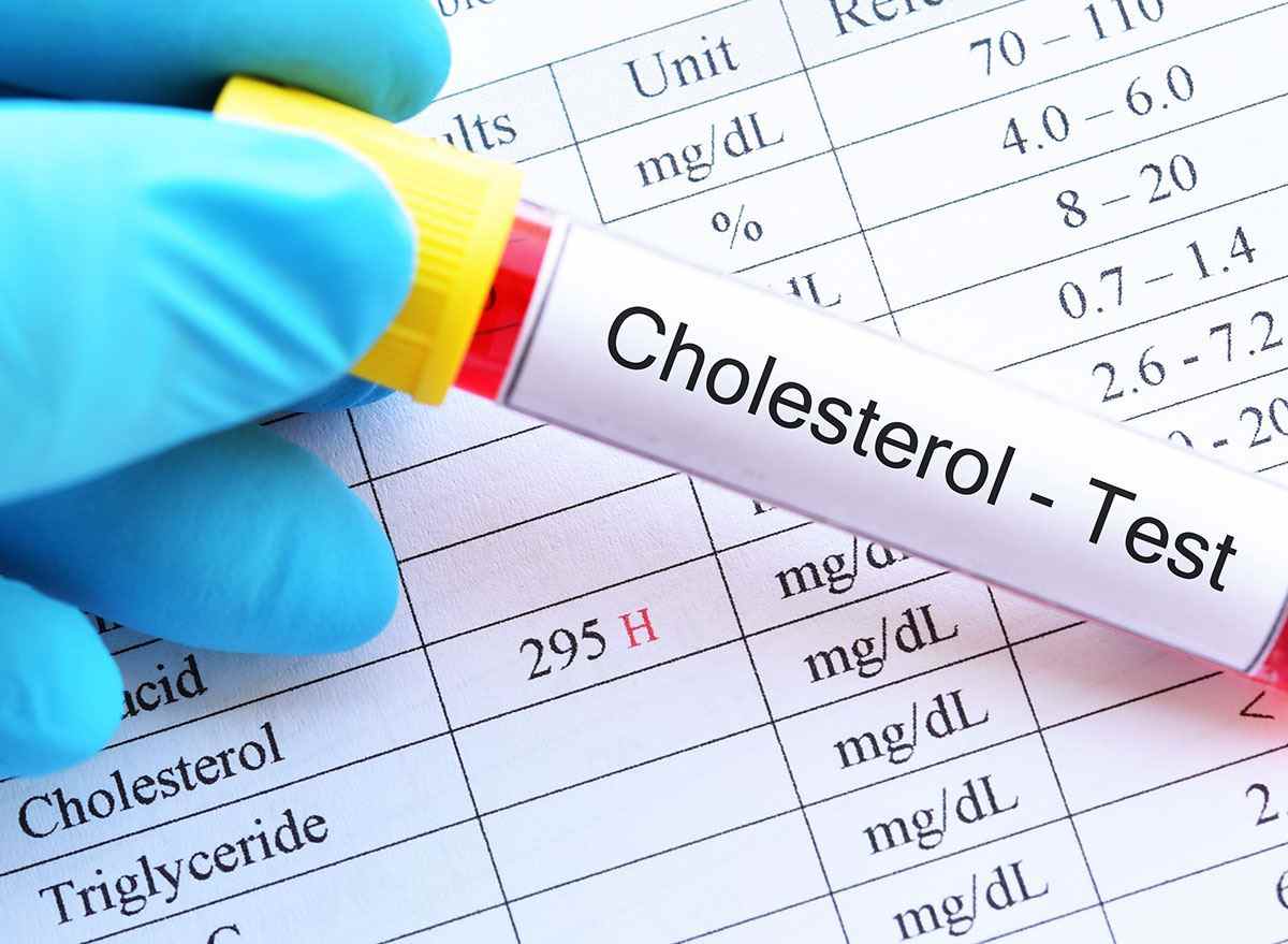 hoher Cholesterinspiegel