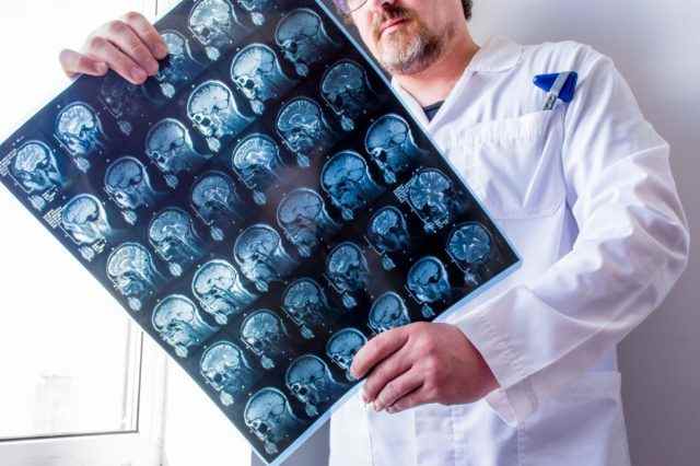 Arzt untersucht MRT-Scan von Kopf, Hals und Gehirn des Patienten