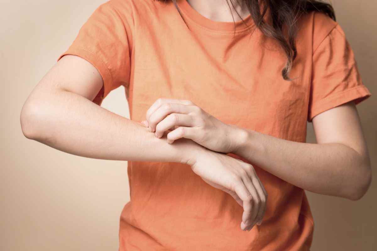 Frauen kratzen sich mit der Hand am juckenden Arm.