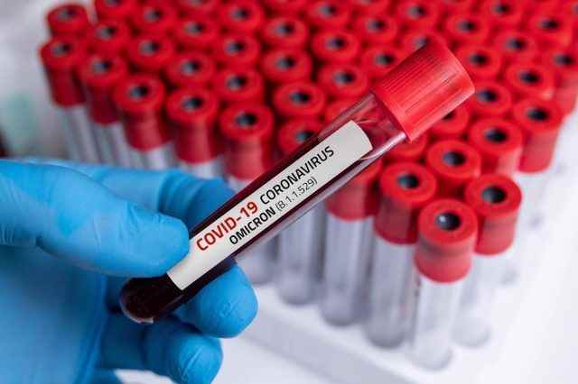 Arzt mit Blutprobe von Covid-19 Omicron B.1.1.529 Variante und allgemeine Daten von Covid-19 Coronavirus-Mutationen.