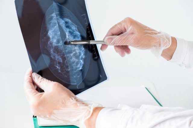 Ärztin, die Mammographieergebnisse auf Röntgen analysiert.