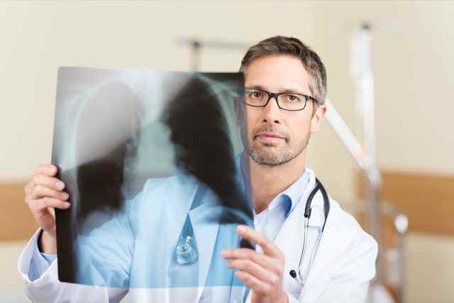 Porträt eines ernsthaften, reifen Arztes, der einen Röntgenbericht im Krankenhaus hält