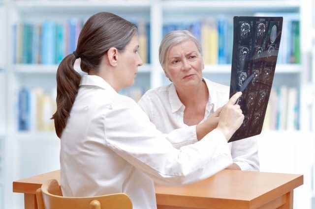 Ärztin mittleren Alters diskutiert mit ihrem älteren Schlaganfallpatienten ct-Scan-Bilder ihres Gehirns