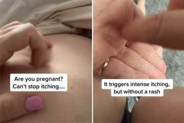 Ich bin Hebamme und deshalb sollten schwangere Frauen juckende Haut NIEMALS ignorieren