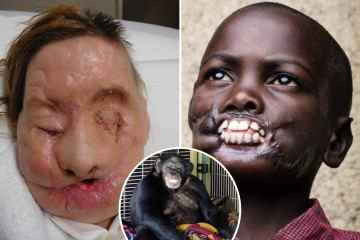 Die schrecklichsten Schimpansenangriffe der Welt, während Affen Gesichter und Genitalien von Menschen abreißen
