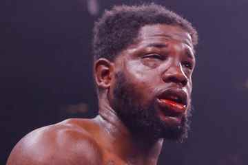 Boxers Gesicht hat sich nach 233 Schlägen „völlig verändert“.
