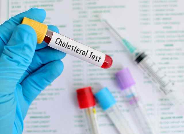 Nahaufnahme des Arztes, der eine Blutprobe für Cholesterin hält