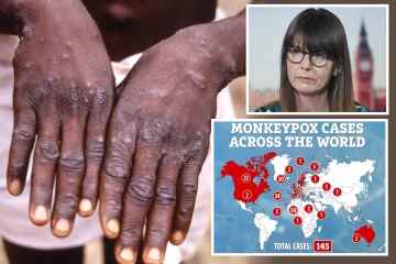 Belgien führt Affenpocken-QUARANTÄNE ein, da sich das Virus in ganz Europa ausbreitet