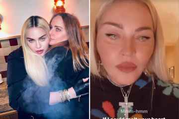 Madonnas Fans sind „besorgt“ wegen des „bizarren und nicht wiederzuerkennenden“ neuen Gesichts der Ikone