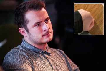 Max Bowden von EastEnders erleidet schmerzhafte Verletzungen, als er wütende Szenen mit Ben Mitchell dreht