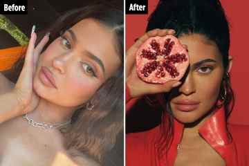 Kylie-Fans loben Star für „natürlichen“ Look mit „weniger Lippenfüllern“