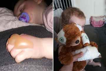 Meine Tochter, 1, erlitt RIESIGE Blasen, als sie von „Großbritanniens gefährlichster Pflanze“ verbrannt wurde