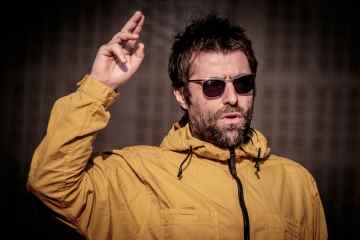 Oasis-Legende Liam Gallagher WIRD sich nach dem Sommer einer Hüftoperation unterziehen