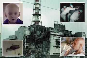 Unsichtbare Bilder von Tschernobyl zeigen in der Explosionszone Babys, die mit Geburtsfehlern geboren wurden