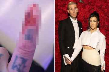 Kourtneys Ehemann Travis postet ein grausiges Foto seines blutüberströmten Fingers