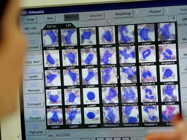 Computerisierte Bluttestergebnisse auf dem Bildschirm