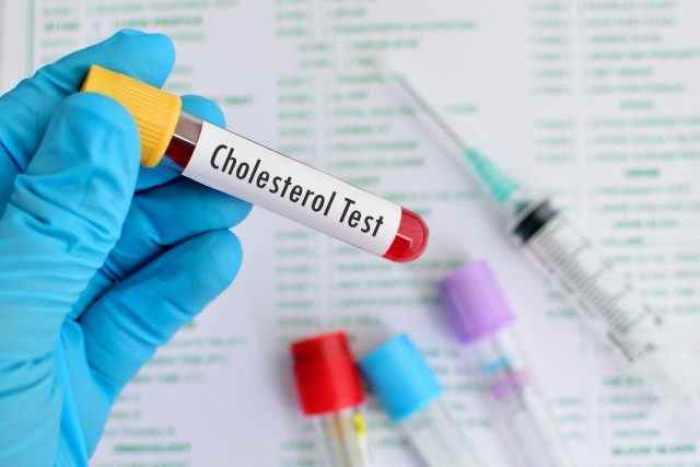 Nahaufnahme des Arztes, der eine Blutprobe für Cholesterin hält