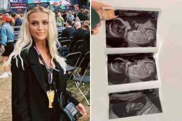 Corries Lucy Fallon teilt Baby-Scan-Fotos, nachdem sie enthüllt hat, dass sie schwanger ist
