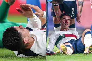 Ronaldo blutüberströmt, nachdem er von einem Torhüter bei einem Horror-Smash ins Gesicht geschlagen wurde