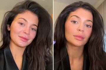 Kylie-Fans bitten sie, „aufzuhören, Make-up zu tragen“, nachdem sie ihre echte Haut gezeigt hat