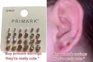 Ich habe süße Ohrringe von Primark gekauft, aber sie haben riesige Löcher in meinen Ohren hinterlassen