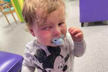 Eine Kindergärtnerin spritzte dem einjährigen Sohn Klebstoff ins Gesicht, während sie Nägel fixierte