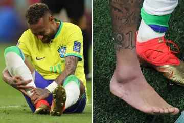 Neymar ging mit entsetztem, geschwollenem Knöchel, als der Teamarzt ein besorgniserregendes Update veröffentlichte