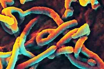 Möglicher Fall von tödlichem Ebola, der untersucht wird, nachdem die Krankenhausklinik „gesperrt“ wurde