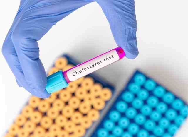 positives Testkonzept für hohen Cholesterinspiegel