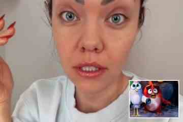 Frau ist entsetzt, nachdem Botox schief geht und sie wie ein Angry Bird aussehen lässt
