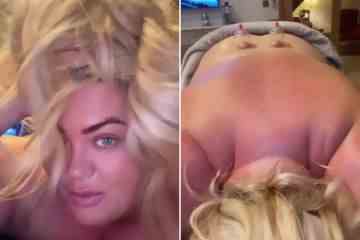 Gemma Collins zieht sich für eine bizarre Schröpfbehandlung komplett nackt aus