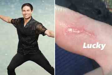 Joey Essex zeigt seine Dancing On Ice-Verletzung nach einem Unfall mit Vanessa Bauer