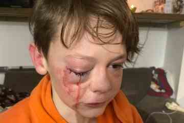 Schockierende Bilder zeigen Jungen, 12, nach brutalem Angriff von „Mann und zwei Teenagern“