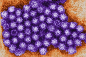 Die 6 Anzeichen von Norovirus, die Sie kennen müssen – da die Fälle zunehmen werden