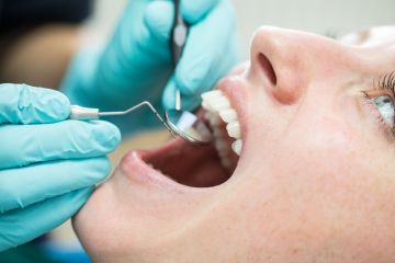 Große Änderung bei NHS-Zahnarztterminen – sehen Sie, wie viel Sie bezahlen müssen