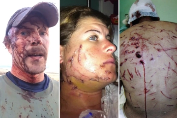 Die schlimmsten Geschichten über Tierangriffe, darunter eine Frau, deren Gesicht von einem HAI gefressen wurde