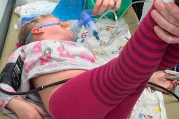 Mutter teilt erschreckendes Bild ihrer Tochter, um die Realität eines anaphylaktischen Schocks zu zeigen