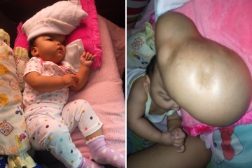 Familie mit Baby mit riesigem Wachstum auf dem Kopf, das verzweifelt um die Hilfe eines Chirurgen bittet