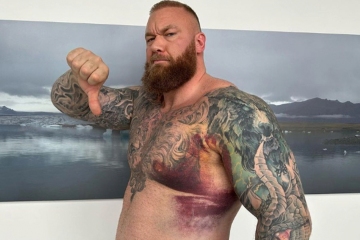 Björnsson schockiert Fans, als Strongman & Game of Thrones-Star brutale Verletzungen enthüllt
