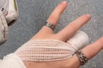 Ein 16-jähriges Mädchen „verliert“ beim Reading Festival die Fingerspitze, nachdem es in der Absperrung steckengeblieben ist