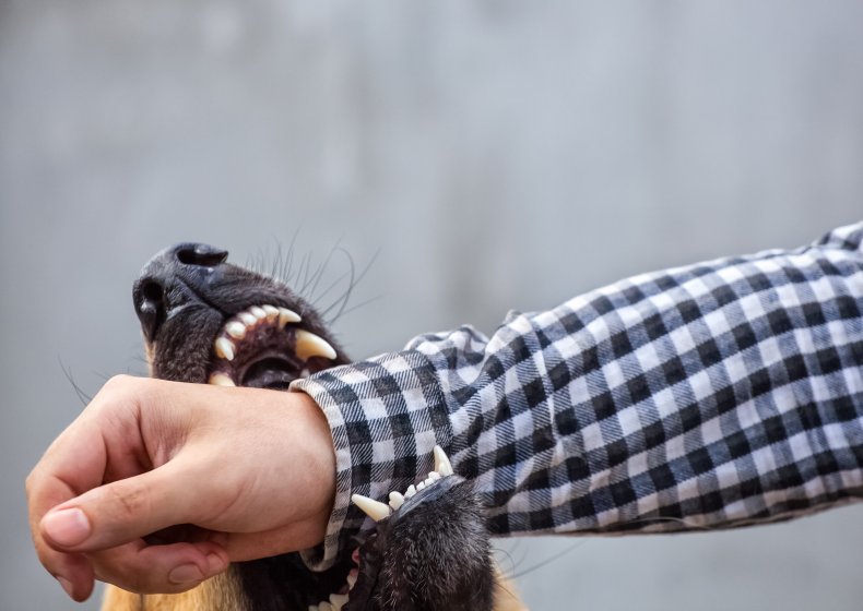 Hund beißt menschlichen Arm.
