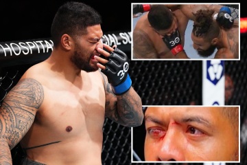 UFC-Kampf abgebrochen, nachdem Star in der ersten Runde eine Horror-Augenverletzung erlitten hat