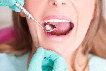 Ich bin Zahnarzt – 5 Warnsignale im Mundbereich, die Sie NIEMALS ignorieren sollten ... sie könnten tödlich sein