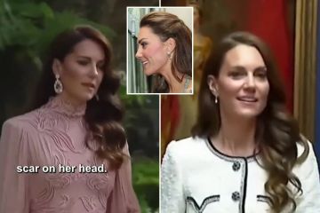 Ich bin ein Stil-Experte – der geheime Haartrick, den Kate Middleton anwendet, um ihre Narbe zu verbergen
