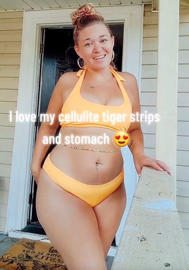 Sie sagte, sie sei stolz auf ihre Cellulite und ihren Bauch