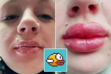I got my lips tattooed but it went wrong…trolls say I look like a Flappy Bird