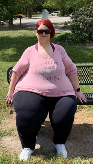 Amanda verlor an Gewicht, sodass sie sich sicher der Operation unterziehen konnte, die sie brauchte