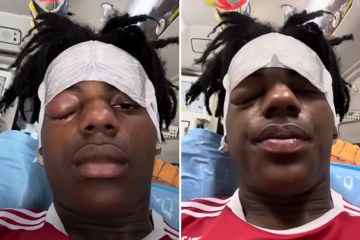 IShowSpeed ​​eilte mit einem schrecklich geschwollenen Auge in die Notoperation