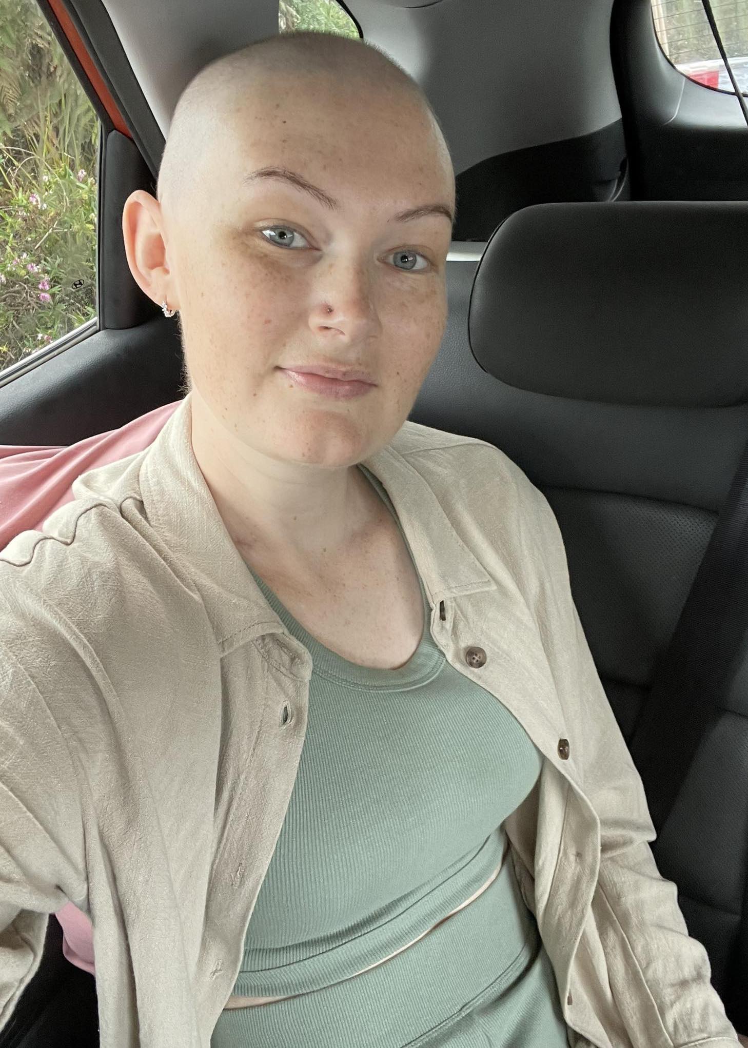 Die Neuseeländerin verlor während einer Chemotherapie ihre Haare